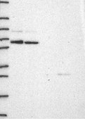 Anti-CCNT1 antibody produced in rabbit Prestige Antibodies® Powered by Atlas Antibodies, affinity isolated antibody, buffered aqueous glycerol solution