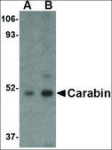 Anti-Carabin (ab1) antibody produced in rabbit affinity isolated antibody, buffered aqueous solution