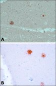Anti-β-Amyloid antibody, Mouse monoclonal clone BAM-10, ascites fluid