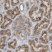 Anti-LAMP1 antibody produced in rabbit Prestige Antibodies® Powered by Atlas Antibodies, affinity isolated antibody, buffered aqueous glycerol solution