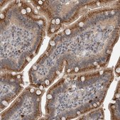 Anti-SCP2 antibody produced in rabbit Prestige Antibodies® Powered by Atlas Antibodies, affinity isolated antibody, buffered aqueous glycerol solution, Ab2