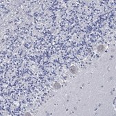 Anti-USP29 antibody produced in rabbit Prestige Antibodies® Powered by Atlas Antibodies, affinity isolated antibody, buffered aqueous glycerol solution