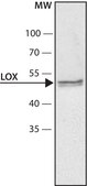 Anti-Lysyl Oxidase antibody produced in rabbit ~1 mg/mL, affinity isolated antibody, buffered aqueous solution