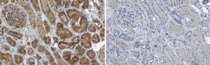 Anti-Interferon-α Antibody purified antibody, clone ST126, from mouse