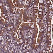 Anti-MIEF2 antibody produced in rabbit Prestige Antibodies® Powered by Atlas Antibodies, affinity isolated antibody, buffered aqueous glycerol solution