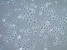 UFH-001 Human Breast Cancer Cell Line The UFH-001 triple negative CAIX+ human breast cancer cell line is suitable as a model for studying the mechanisms of triple negative breast cancer progression, metastasis and migration.