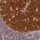 Anti-HMCES antibody produced in rabbit Prestige Antibodies® Powered by Atlas Antibodies, affinity isolated antibody, buffered aqueous glycerol solution