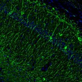 Anti-MAP2 antibody produced in rabbit Prestige Antibodies® Powered by Atlas Antibodies, affinity isolated antibody, buffered aqueous glycerol solution