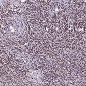 Anti-TRIM22 antibody produced in rabbit Ab2, Prestige Antibodies® Powered by Atlas Antibodies, affinity isolated antibody, buffered aqueous glycerol solution