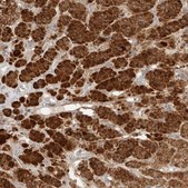 Anti-RAB32 antibody produced in rabbit Prestige Antibodies® Powered by Atlas Antibodies, affinity isolated antibody, buffered aqueous glycerol solution