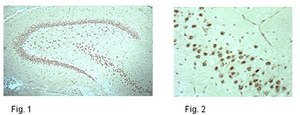 Anti-phospho NR1 (Ser897) Antibody from rabbit, purified by affinity chromatography