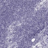 Anti-SLC22A6 Prestige Antibodies® Powered by Atlas Antibodies, affinity isolated antibody