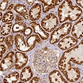 Anti-SDHB antibody produced in rabbit Prestige Antibodies® Powered by Atlas Antibodies, affinity isolated antibody, buffered aqueous glycerol solution