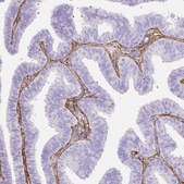 Anti-FBN1 antibody produced in rabbit Prestige Antibodies® Powered by Atlas Antibodies, affinity isolated antibody, buffered aqueous glycerol solution