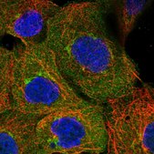 Anti-UBAP1 antibody produced in rabbit Prestige Antibodies® Powered by Atlas Antibodies, affinity isolated antibody, buffered aqueous glycerol solution, Ab2