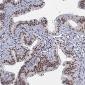 Anti-METTL14 antibody produced in rabbit Prestige Antibodies® Powered by Atlas Antibodies, affinity isolated antibody, buffered aqueous glycerol solution