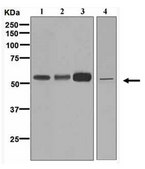 Anti-FADS1, clone EPR6898, Rabbit Monoclonal Antibody clone EPR6898, from rabbit