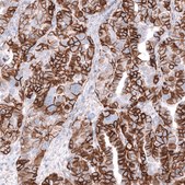 Anti-NCAM1 antibody produced in mouse Prestige Antibodies® Powered by Atlas Antibodies, clone CL12732, purified by using Protein A, buffered aqueous glycerol solution