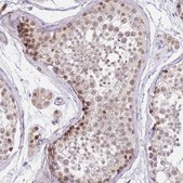 Anti-PUS10 antibody produced in rabbit Prestige Antibodies® Powered by Atlas Antibodies, affinity isolated antibody, buffered aqueous glycerol solution