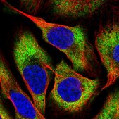Anti-CHAC2 antibody produced in rabbit Prestige Antibodies® Powered by Atlas Antibodies, affinity isolated antibody, buffered aqueous glycerol solution