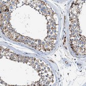 Anti-GOT2 antibody produced in rabbit Prestige Antibodies® Powered by Atlas Antibodies, affinity isolated antibody, buffered aqueous glycerol solution