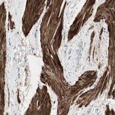 Anti-DMPK antibody produced in rabbit Ab1, Prestige Antibodies® Powered by Atlas Antibodies, affinity isolated antibody, buffered aqueous glycerol solution