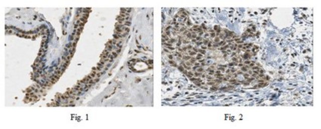Anti-PALB2 Antibody from rabbit, purified by affinity chromatography