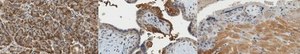 Anti-TGF-beta Receptor Antibody, type I from rabbit, purified by affinity chromatography