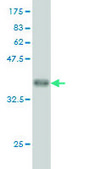 Monoclonal Anti-RPL9 antibody produced in mouse clone 2F11, purified immunoglobulin, buffered aqueous solution