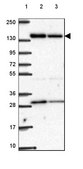 Anti-ACAD10 antibody produced in rabbit Prestige Antibodies® Powered by Atlas Antibodies, affinity isolated antibody, buffered aqueous glycerol solution