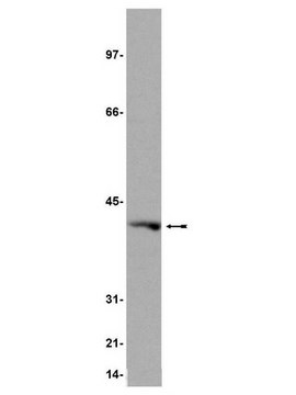 Anti-Gi&#945;1 Antibody, clone 7H7 clone 7H7, Upstate&#174;, from mouse