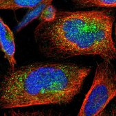 Anti-YIPF6 antibody produced in rabbit Prestige Antibodies® Powered by Atlas Antibodies, affinity isolated antibody, buffered aqueous glycerol solution