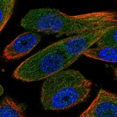 Anti-RNF31 antibody produced in rabbit Prestige Antibodies® Powered by Atlas Antibodies, affinity isolated antibody, buffered aqueous glycerol solution