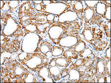 Anti-IL6 affinity isolated antibody
