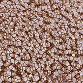 Anti-SLC2A2 antibody produced in rabbit Prestige Antibodies® Powered by Atlas Antibodies, affinity isolated antibody, buffered aqueous glycerol solution