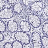 Anti-HLA-DQB2 antibody produced in rabbit Prestige Antibodies® Powered by Atlas Antibodies, affinity isolated antibody, buffered aqueous glycerol solution