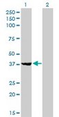 Monoclonal Anti-EIF2B2 antibody produced in mouse clone 5B12-E10, purified immunoglobulin, buffered aqueous solution