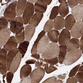 Anti-OSBPL6 antibody produced in rabbit Prestige Antibodies® Powered by Atlas Antibodies, affinity isolated antibody, buffered aqueous glycerol solution