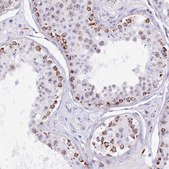 Anti-TFAM antibody produced in rabbit Prestige Antibodies® Powered by Atlas Antibodies, affinity isolated antibody, buffered aqueous glycerol solution