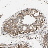 Anti-MRPS22 antibody produced in rabbit Prestige Antibodies® Powered by Atlas Antibodies, affinity isolated antibody, buffered aqueous glycerol solution