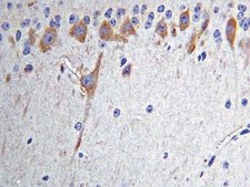 Anti-Nitrotyrosine Antibody, clone 2A8.2 clone 2A8.2, Chemicon®, from mouse
