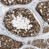 Anti-USP30 antibody produced in rabbit Prestige Antibodies® Powered by Atlas Antibodies, affinity isolated antibody, buffered aqueous glycerol solution