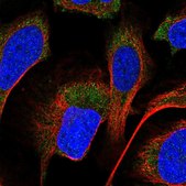 Anti-PPM1A antibody produced in rabbit Prestige Antibodies® Powered by Atlas Antibodies, affinity isolated antibody, buffered aqueous glycerol solution