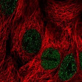 Anti-PLCXD2 antibody produced in rabbit Prestige Antibodies® Powered by Atlas Antibodies, affinity isolated antibody, buffered aqueous glycerol solution