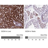 Anti-GCDH antibody produced in rabbit Prestige Antibodies® Powered by Atlas Antibodies, affinity isolated antibody, buffered aqueous glycerol solution