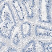 Anti-MUC7 antibody produced in rabbit Prestige Antibodies® Powered by Atlas Antibodies, affinity isolated antibody, buffered aqueous glycerol solution