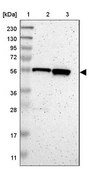 Anti-C17orf80 antibody produced in rabbit Prestige Antibodies® Powered by Atlas Antibodies, affinity isolated antibody, buffered aqueous glycerol solution