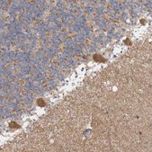 Anti-C17orf53 antibody produced in rabbit Prestige Antibodies® Powered by Atlas Antibodies, affinity isolated antibody, buffered aqueous glycerol solution, Ab2