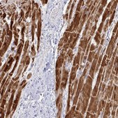 Anti-NDUFA7 antibody produced in rabbit Prestige Antibodies® Powered by Atlas Antibodies, affinity isolated antibody, buffered aqueous glycerol solution