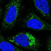 Anti-NDUFC1 antibody produced in rabbit Prestige Antibodies® Powered by Atlas Antibodies, affinity isolated antibody, buffered aqueous glycerol solution